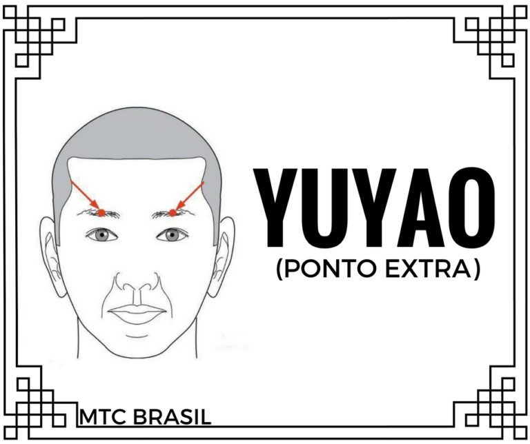 Ponto de acupuntura Yuyao 魚腰 Medicina Tradicional Chinesa Brasil